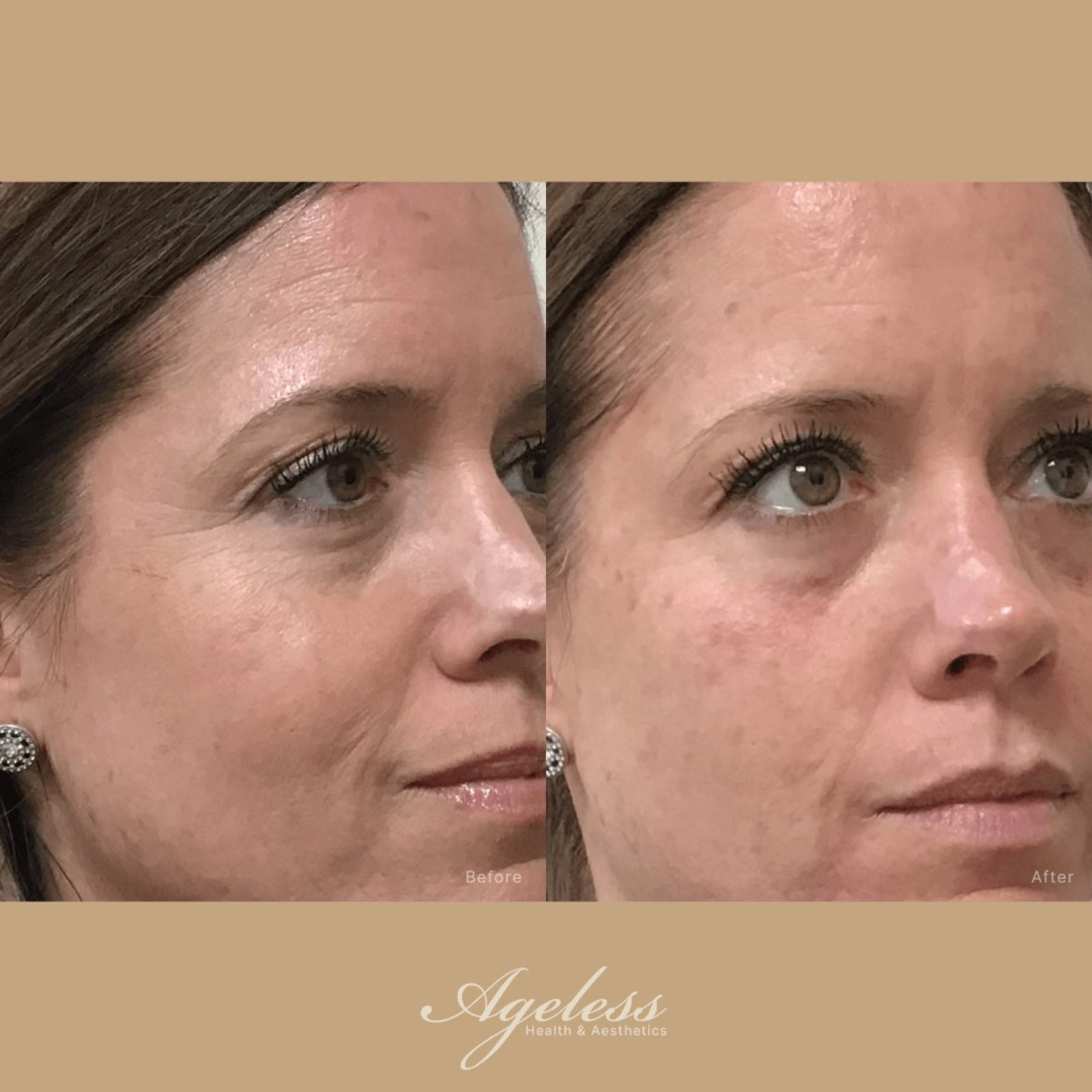 Before and after of a glass skin facial in three-quarter view — smoother, more luminous skin after